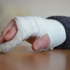 Rehabilitacja po złamaniu ręki: Ile trwa i jak przyspieszyć powrót?