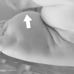 Delikatne paluszki dziecka, biała strzałka wskazuje na miękkie uczucie poduszki pod stopą.