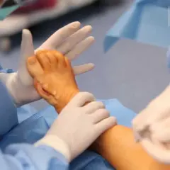 Jak wygląda operacja haluksa? Przewodnik od A do Z dla pacjenta