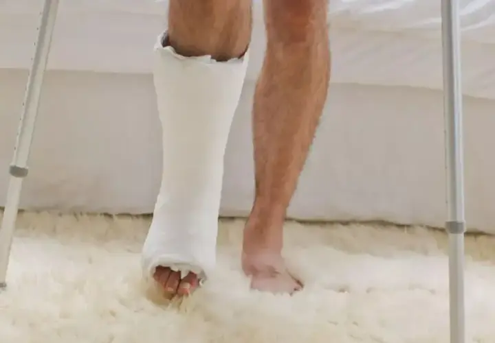 Osoba z gipsem na nodze i kulami, przygotowuje się do ćwiczeń, jak samemu rehabilitować stopę po złamaniu.