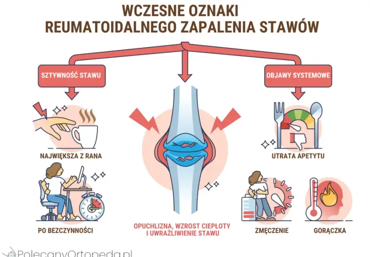 Wczesne objawy RZS: sztywność stawu, opuchlizna, zmęczenie, gorączka, utrata apetytu. Zwróć uwagę na te sygnały.