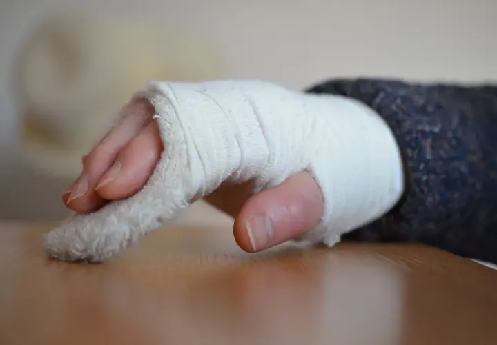 Rehabilitacja po złamaniu ręki: Ile trwa i jak przyspieszyć powrót?