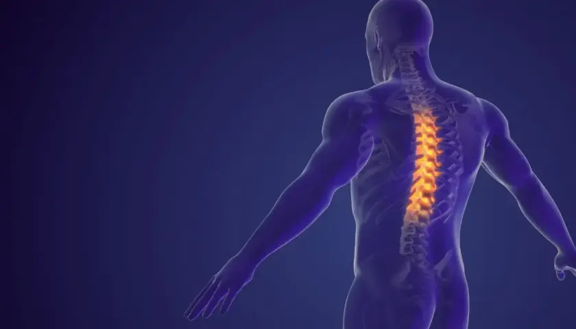 Anatomical model of a human torso showing a spine with highlighted areas indicating dyskopatia wielopoziomowa.