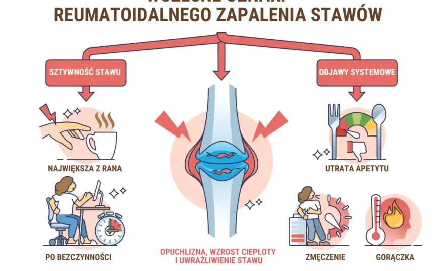 Pierwsze objawy reumatoidalnego zapalenia stawów - jak je rozpoznać?