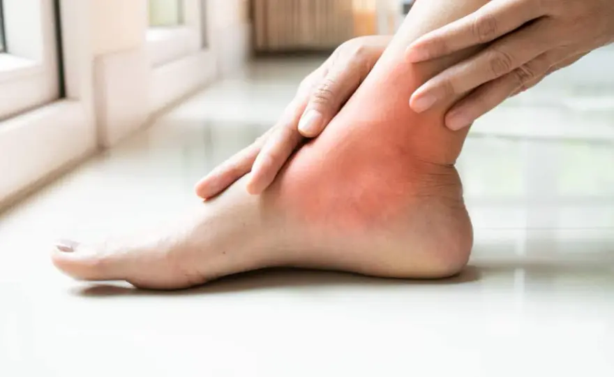 Palce stopy bolą? Deformacje, urazy i kiedy iść do ortopedy