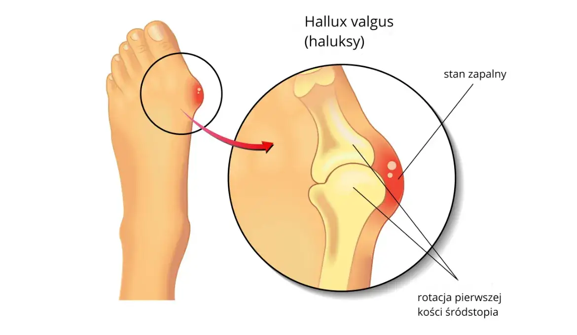 Anatomia stopy haluks