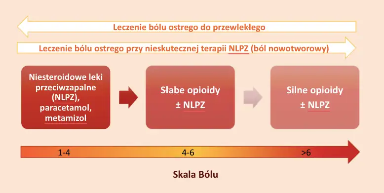 Diagram wyboru leku na ból głowy