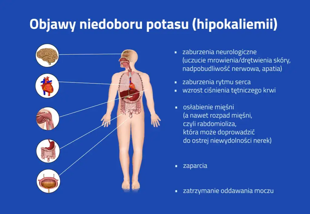 objawy niedoboru potasu grafika